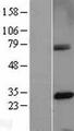 CENPH / CENP-H Protein - Western validation with an anti-DDK antibody * L: Control HEK293 lysate R: Over-expression lysate