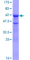 CENPH / CENP-H Protein - 12.5% SDS-PAGE of human CENPH stained with Coomassie Blue