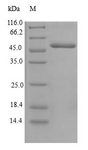 CENPH / CENP-H Protein - (Tris-Glycine gel) Discontinuous SDS-PAGE (reduced) with 5% enrichment gel and 15% separation gel.