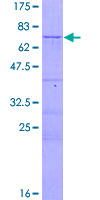 CENPJ / LAP Protein - 12.5% SDS-PAGE of human CENPJ stained with Coomassie Blue