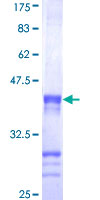 CENPJ / LAP Protein - 12.5% SDS-PAGE Stained with Coomassie Blue.