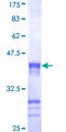 CENPJ / LAP Protein - 12.5% SDS-PAGE Stained with Coomassie Blue.