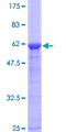 CENPK Protein - 12.5% SDS-PAGE of human CENPK stained with Coomassie Blue