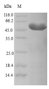 CENPK Protein - (Tris-Glycine gel) Discontinuous SDS-PAGE (reduced) with 5% enrichment gel and 15% separation gel.