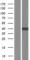 CENPL Protein - Western validation with an anti-DDK antibody * L: Control HEK293 lysate R: Over-expression lysate