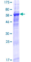 CENPL Protein - 12.5% SDS-PAGE of human CENPL stained with Coomassie Blue