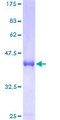 CENPM Protein - 12.5% SDS-PAGE of human C22orf18 stained with Coomassie Blue