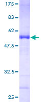 CENPN / CENP-N Protein - 12.5% SDS-PAGE of human BM039 stained with Coomassie Blue