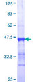 CENPP Protein - 12.5% SDS-PAGE Stained with Coomassie Blue.