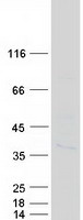 CENPP Protein - Purified recombinant protein CENPP was analyzed by SDS-PAGE gel and Coomassie Blue Staining