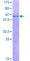 CENPQ Protein - 12.5% SDS-PAGE of human C6orf139 stained with Coomassie Blue