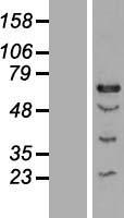 CENPT Protein - Western validation with an anti-DDK antibody * L: Control HEK293 lysate R: Over-expression lysate