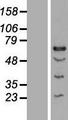 CENPT Protein - Western validation with an anti-DDK antibody * L: Control HEK293 lysate R: Over-expression lysate