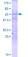 CENPT Protein - 12.5% SDS-PAGE of human CENPT stained with Coomassie Blue