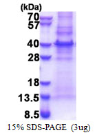 CENPU / MLF1IP Protein