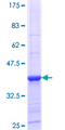 CENPV / p30 Protein - 12.5% SDS-PAGE Stained with Coomassie Blue.