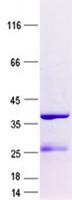 CENPW / C6orf173 Protein