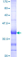 CENTB1 / ACAP1 Protein - 12.5% SDS-PAGE Stained with Coomassie Blue.