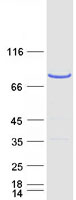CENTB1 / ACAP1 Protein - Purified recombinant protein ACAP1 was analyzed by SDS-PAGE gel and Coomassie Blue Staining