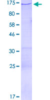 CENTD2 / ARAP1 Protein - 12.5% SDS-PAGE of human ARAP1 stained with Coomassie Blue