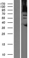 CENTG2 / AGAP1 Protein - Western validation with an anti-DDK antibody * L: Control HEK293 lysate R: Over-expression lysate