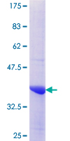 CENTG2 / AGAP1 Protein - 12.5% SDS-PAGE Stained with Coomassie Blue.