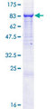CEP104 Protein - 12.5% SDS-PAGE of human KIAA0562 stained with Coomassie Blue
