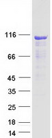 CEP104 Protein - Purified recombinant protein CEP104 was analyzed by SDS-PAGE gel and Coomassie Blue Staining