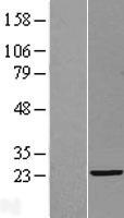 CEP19 / C3orf34 Protein - Western validation with an anti-DDK antibody * L: Control HEK293 lysate R: Over-expression lysate