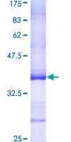 CEP250 / C-NAP1 Protein - 12.5% SDS-PAGE Stained with Coomassie Blue.