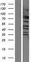 CEP57L1 Protein - Western validation with an anti-DDK antibody * L: Control HEK293 lysate R: Over-expression lysate
