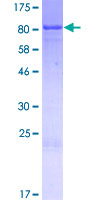 CEP70 Protein - 12.5% SDS-PAGE of human CEP70 stained with Coomassie Blue