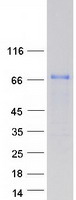 CEP72 Protein - Purified recombinant protein CEP72 was analyzed by SDS-PAGE gel and Coomassie Blue Staining