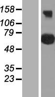 CEP76 Protein - Western validation with an anti-DDK antibody * L: Control HEK293 lysate R: Over-expression lysate