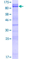 CEP76 Protein - 12.5% SDS-PAGE of human CEP76 stained with Coomassie Blue