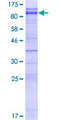 CEP76 Protein - 12.5% SDS-PAGE of human CEP76 stained with Coomassie Blue