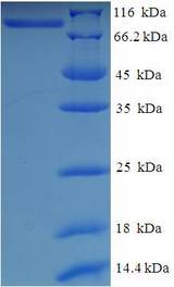 CEP83 / CCDC41 Protein