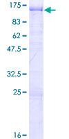 CEP85 / CCDC21 Protein - 12.5% SDS-PAGE of human CCDC21 stained with Coomassie Blue