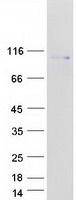 CEP85 / CCDC21 Protein - Purified recombinant protein CEP85 was analyzed by SDS-PAGE gel and Coomassie Blue Staining