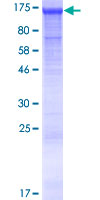 CEP97 Protein - 12.5% SDS-PAGE of human LRRIQ2 stained with Coomassie Blue