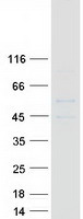 CEPT1 Protein - Purified recombinant protein CEPT1 was analyzed by SDS-PAGE gel and Coomassie Blue Staining