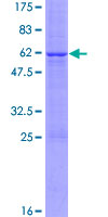 CER1 Protein - 12.5% SDS-PAGE of human CER1 stained with Coomassie Blue