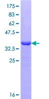 CER1 Protein - 12.5% SDS-PAGE Stained with Coomassie Blue.