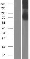 CERCAM Protein - Western validation with an anti-DDK antibody * L: Control HEK293 lysate R: Over-expression lysate