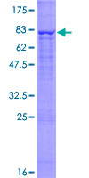 CERCAM Protein - 12.5% SDS-PAGE of human CEECAM1 stained with Coomassie Blue