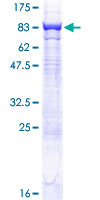 CES2 / Esterase Protein - 12.5% SDS-PAGE of human CES2 stained with Coomassie Blue