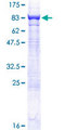 CES2 / Esterase Protein - 12.5% SDS-PAGE of human CES2 stained with Coomassie Blue