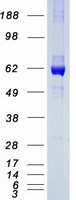 CES2 / Esterase Protein - Purified recombinant protein CES2 was analyzed by SDS-PAGE gel and Coomassie Blue Staining