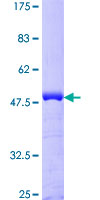 CETN1 Protein - 12.5% SDS-PAGE of human CETN1 stained with Coomassie Blue