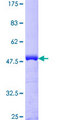 CETN1 Protein - 12.5% SDS-PAGE of human CETN1 stained with Coomassie Blue